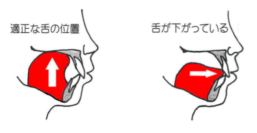 適正な舌の位置図